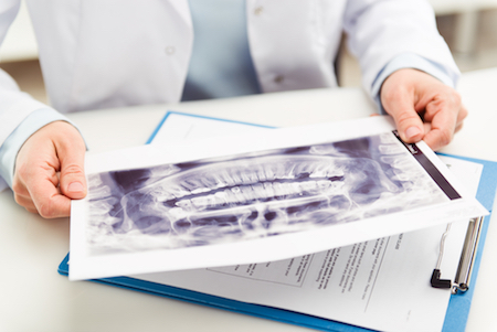 Dentist checking out x-rays to determine what treatments from the list of general dentistry services are needed. 